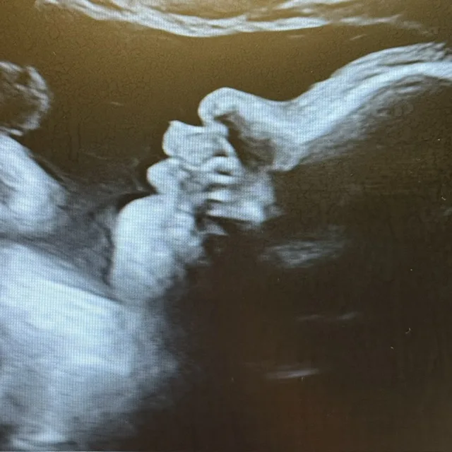Beautiful Beginings Ultrasound black and white nj mom