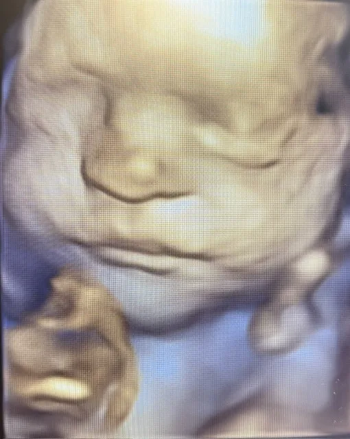 Beautiful Beginnings Ultrasound beige nj mom