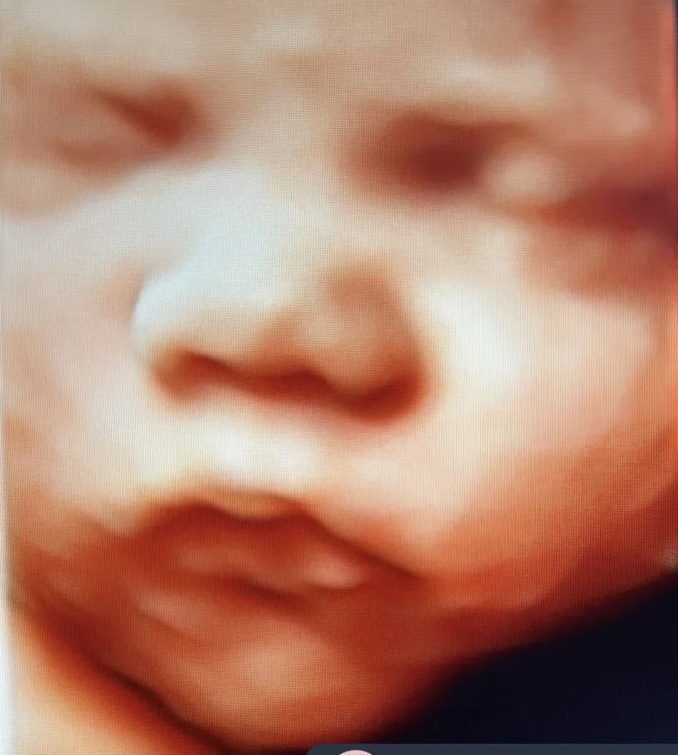 Beautiful Beginnings Ultrasound face nj mom