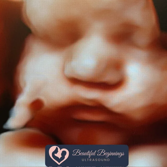 Beautiful Beginnings Ultrasound logo face nj mom